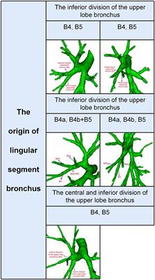 Analysis of variations in the bronchovascular pattern of the lingular segment to explore the correlations between the lingular segment artery and left superior division veins